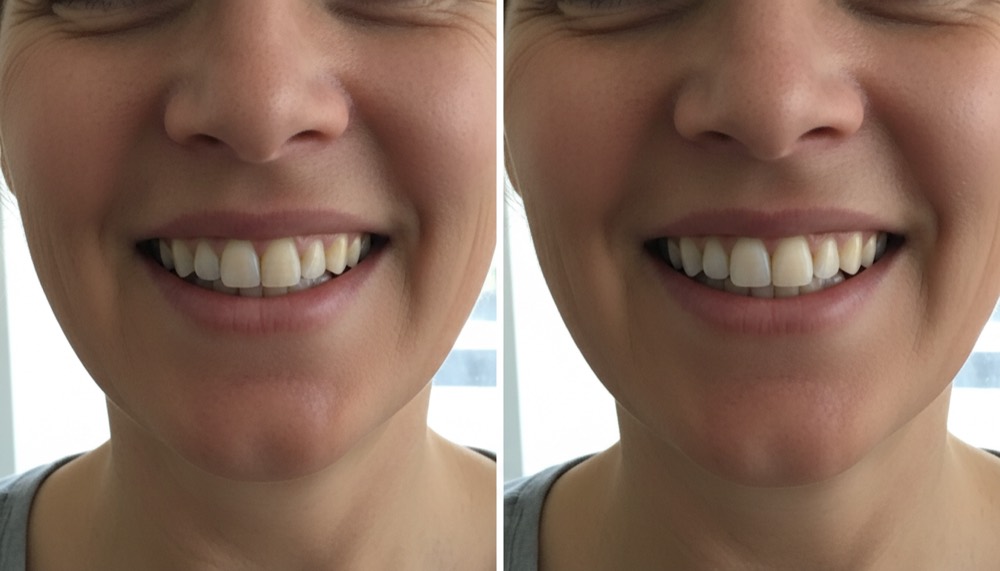 Day one on the left, day 24 on the right, same window